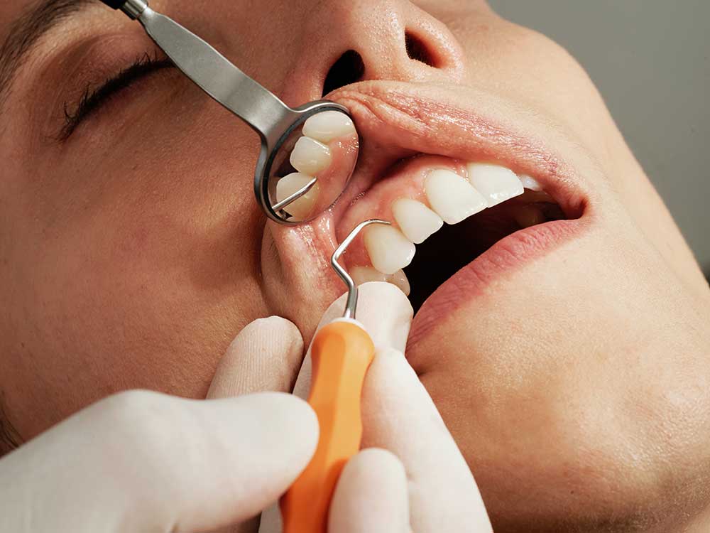 Mantención periodontal Pudahuel