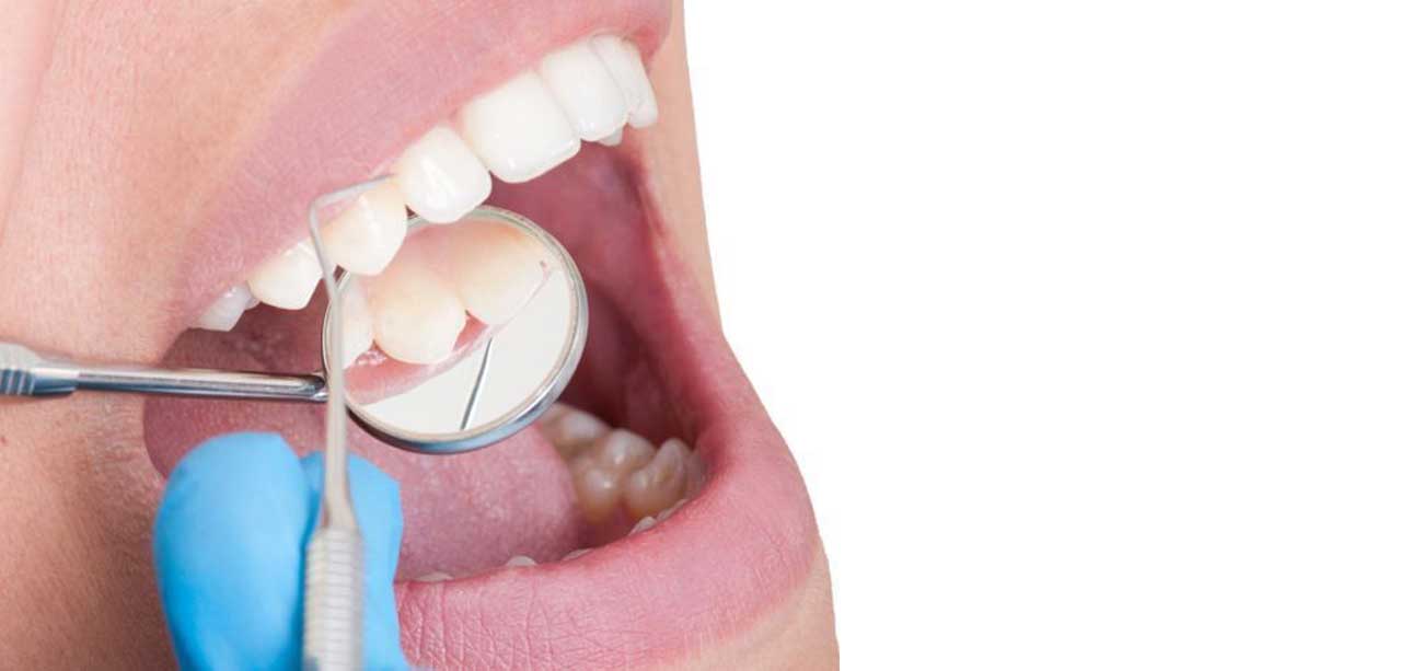 Mantención periodontal Peñalolen