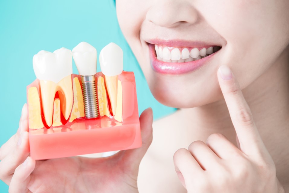 Implantes Dentales Independencia